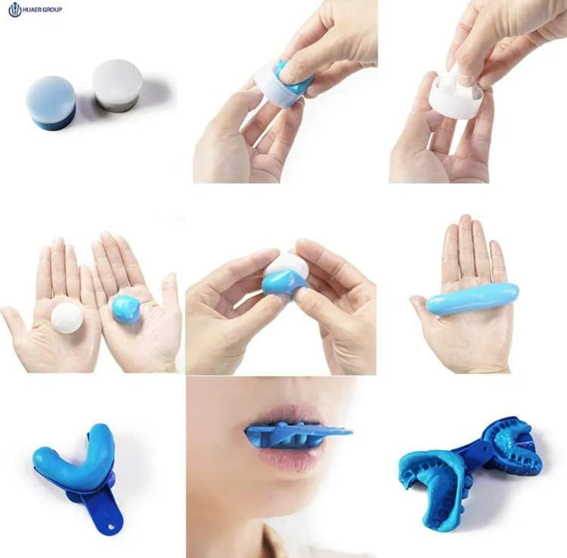 Grillz Teeth Molding Kit - Mars Jewelers