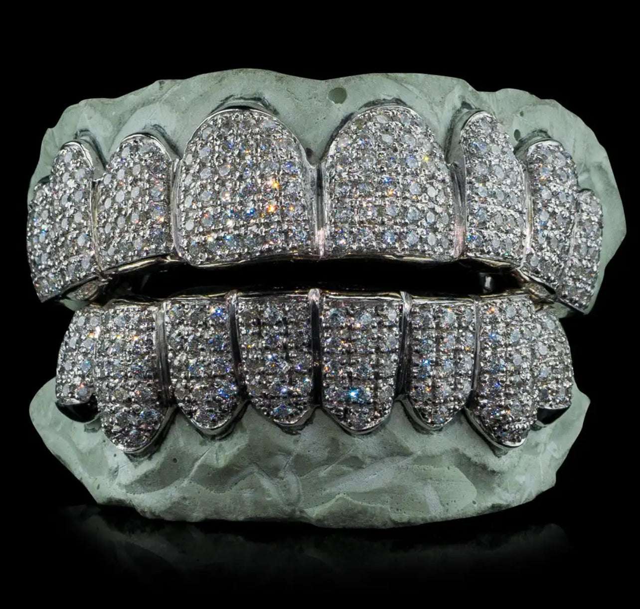 Custom Moissanite Grillz - Mars Jewelers