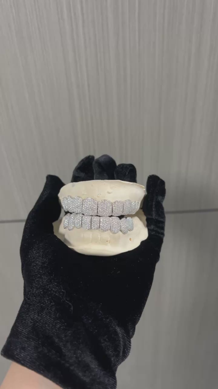 Custom Moissanite Grillz, Video Display, Top and Bottom Molds